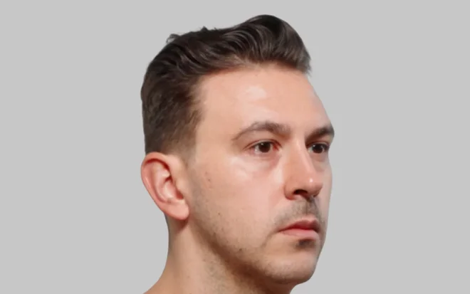 Before Image