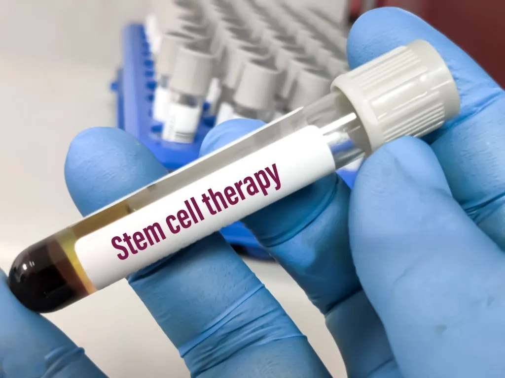 Stem cell treatment with expert doctor at elegant hoopoe