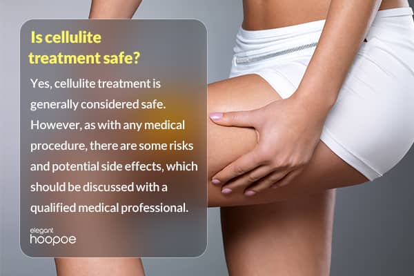 do cellulite treatments actually work