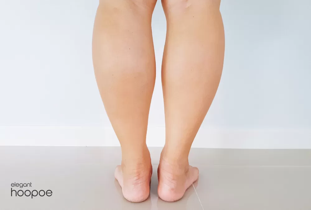 What is a calf fat reduction surgery?