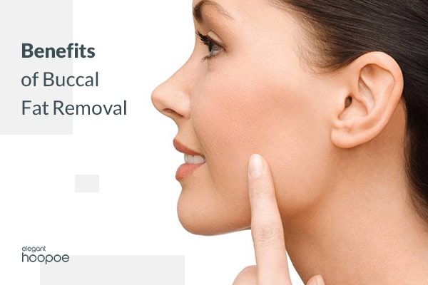 8 immediate benefits of buccal fat removal 