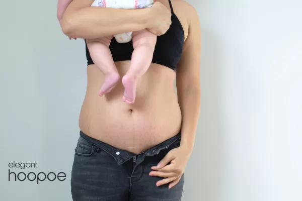 Belly fat after childbirth