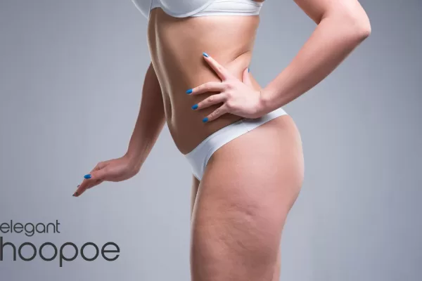ICOONE Cellulite Treatment UAE
