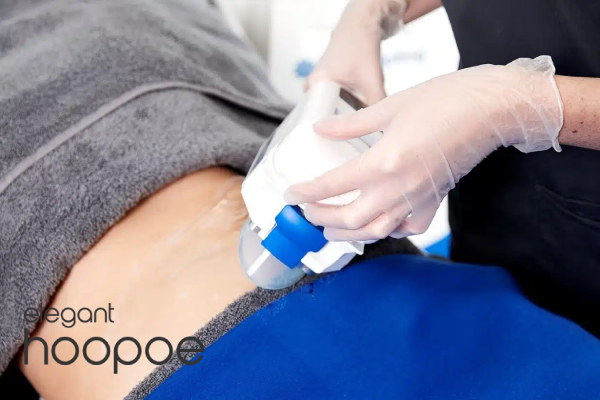  truSculpt ID vs. Coolsculpting in terms of side effects