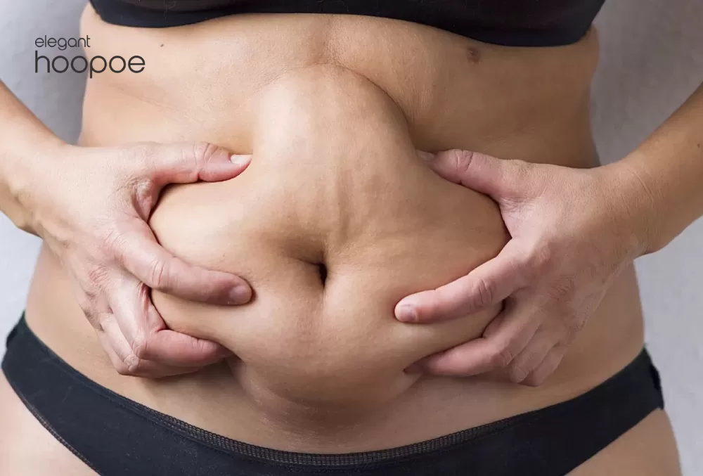 Non-surgical fat removal in Dubai