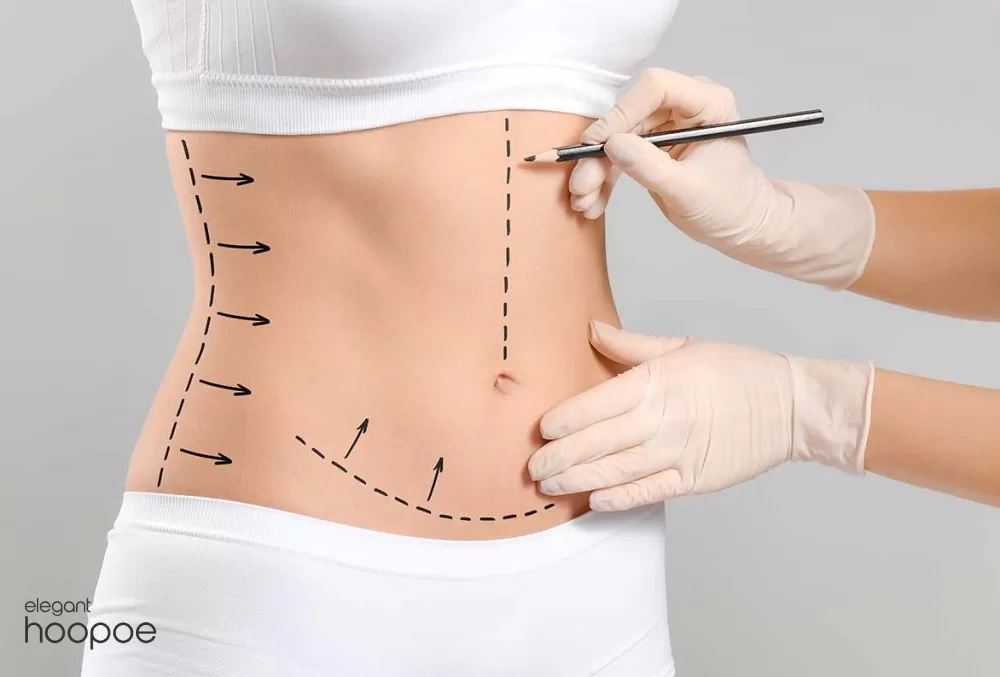 How Does Micro Liposuction Work?