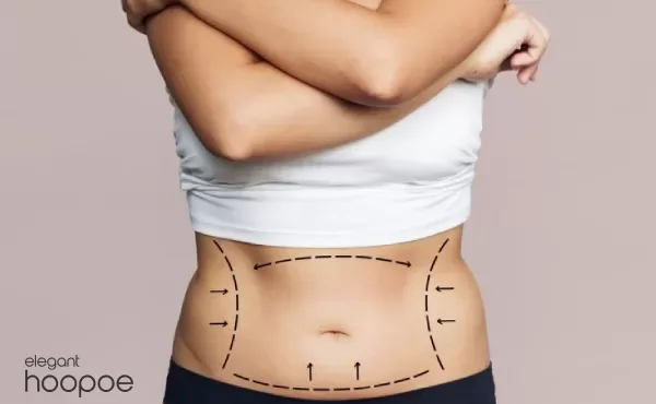 Micro Liposuction: The Less Invasive Path to Body ...
