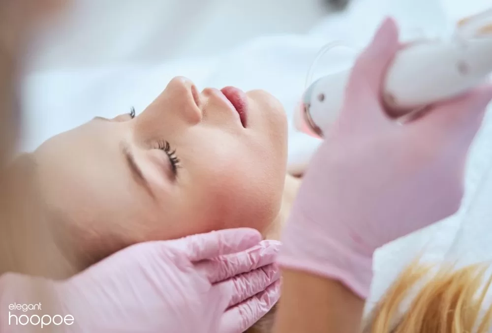 How Does Vivace Microneedling Work?