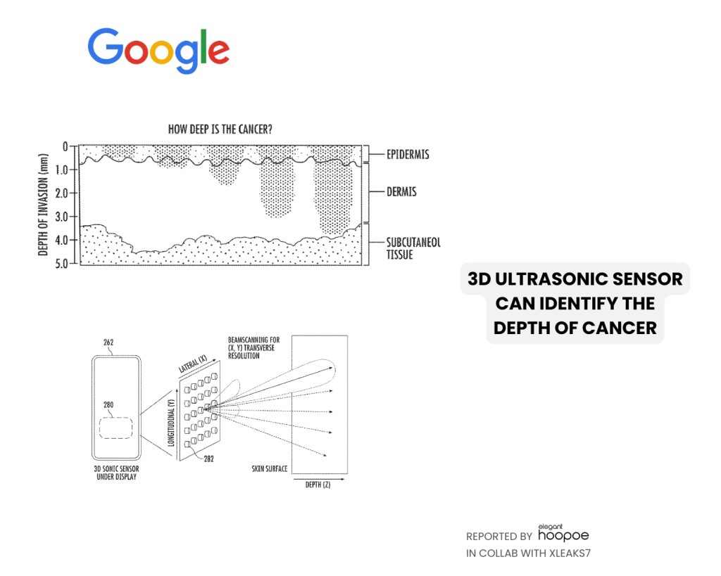 3D ultrasonic sensor is used for skin cancer diagnostics