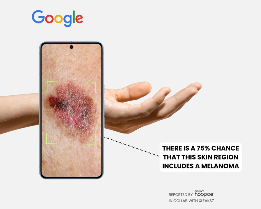 Google's patented technology for skin cancer diagnostics