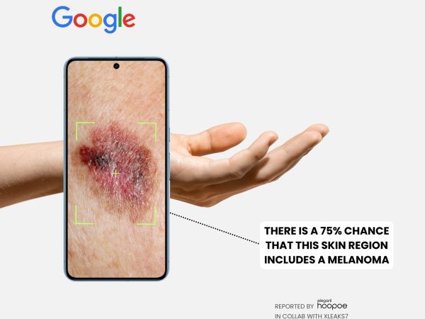 Your Smartphone Can Turn into Skin Cancer Diagnostic Tool, Thanks to 3D Ultrasonic Sensor