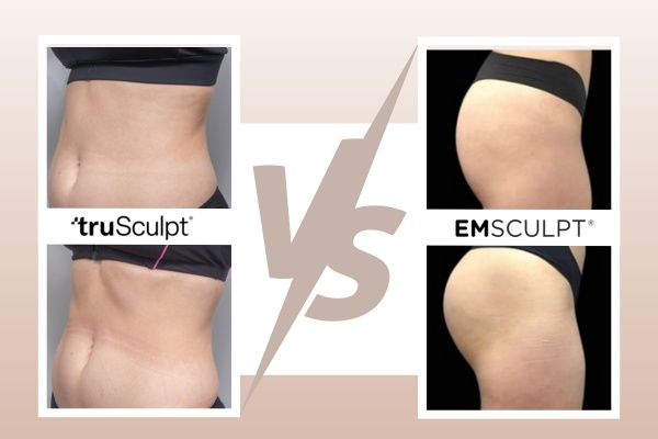 truSculpt vs Emsculpt Comparison