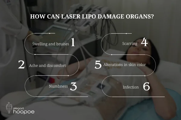 How Can Laser Lipo Damage Organs?