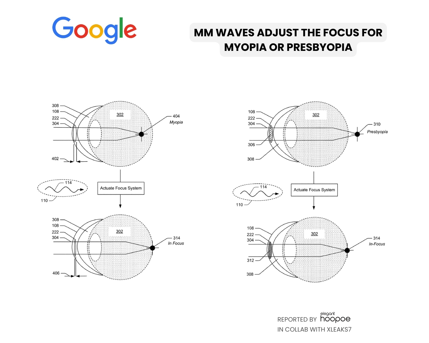 mm waves adjust focus for myopia and presbyopia