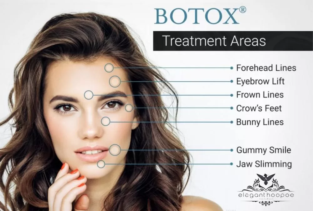 botox treatment