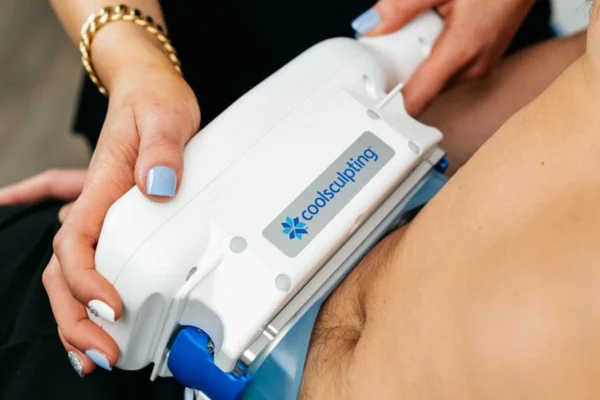 Understanding CoolSculpting