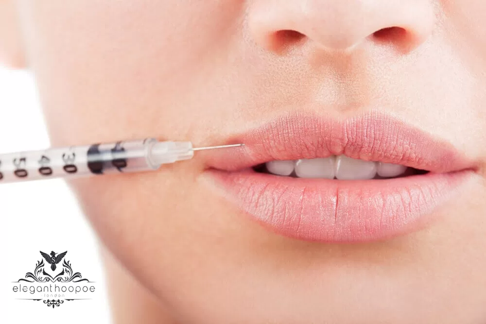 lip fillers in UAE