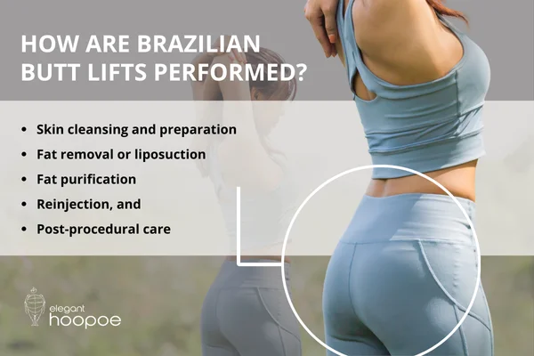 Brazilian Butt Lift Safety What Every Patient Must Know Elegant Hoopoe