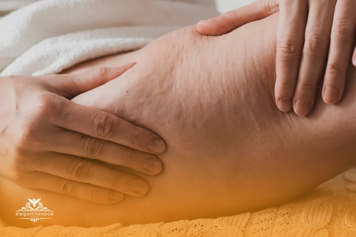 Close-up of hands applying massage to a thigh with visible cellulite dimples