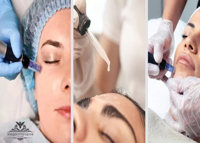 HYDRAFACIAL