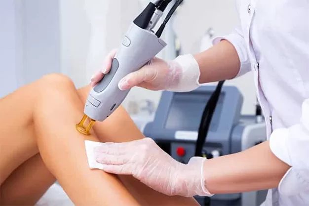 laser hair removal dubai