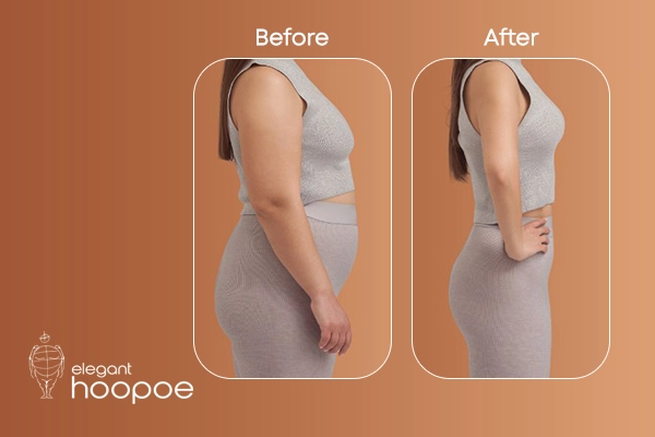 Before and After Fat freezing treatment in Duba