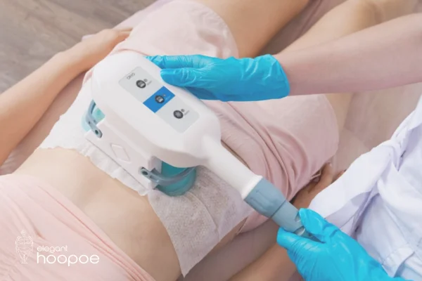 A 7-Step Guide to Prepare for a CoolSculpting Session in Dubai