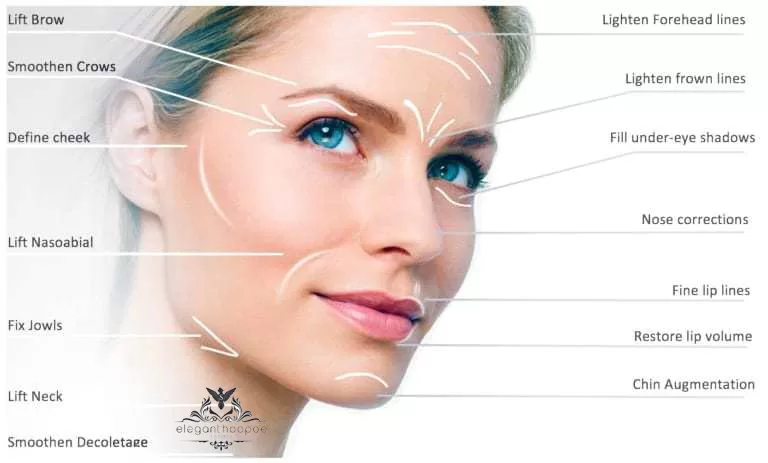 facelift treatment