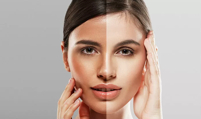 skin brightening in dubai