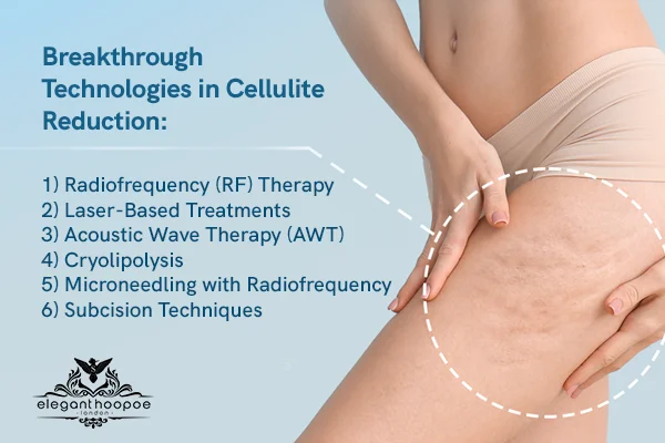 Breakthrough Technologies in Cellulite Reduction