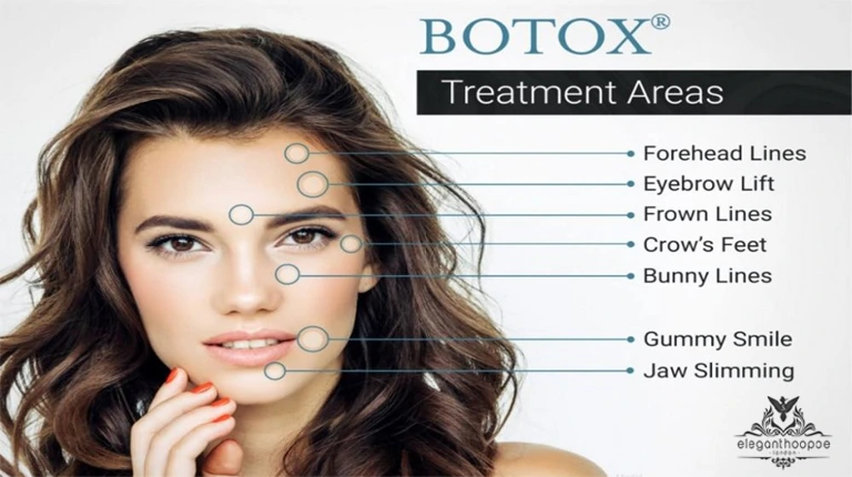 Botox Treatment