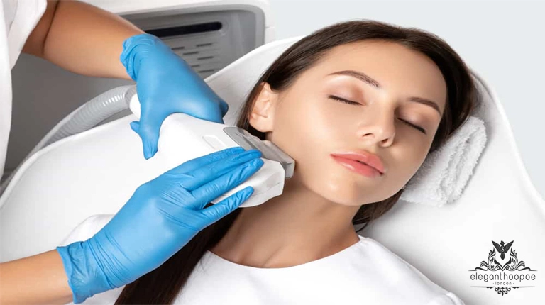 facial laser hair removal