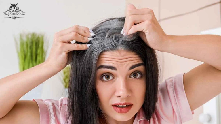 Premature Hair Greying