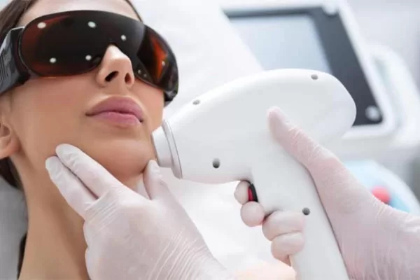 Facial Laser Hair Removal Dubai: A Permanent Solution to Unwanted Hair