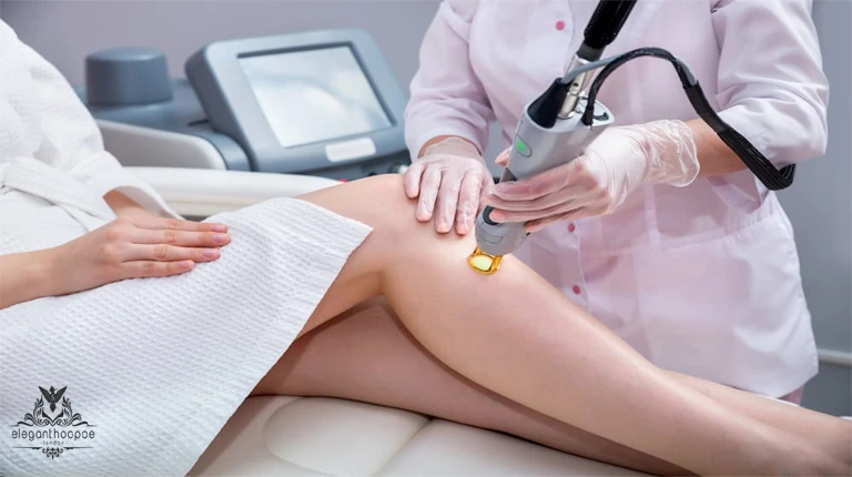 full body hair removal