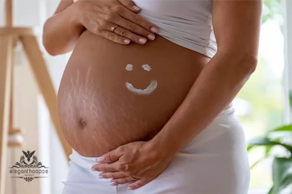 Pregnancy Stretch Marks: Why They Happen and How to Avoid Them