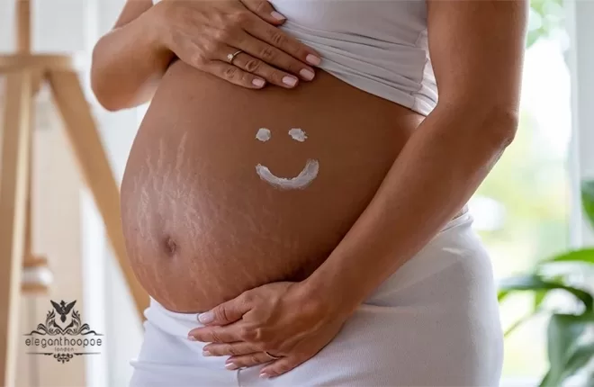 pregnancy stretch marks