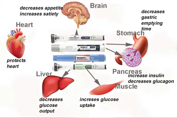 Diagram showing the effects of weight loss medications on various organs.