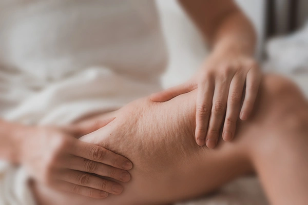 Hands gently massaging thigh with visible cellulite lines