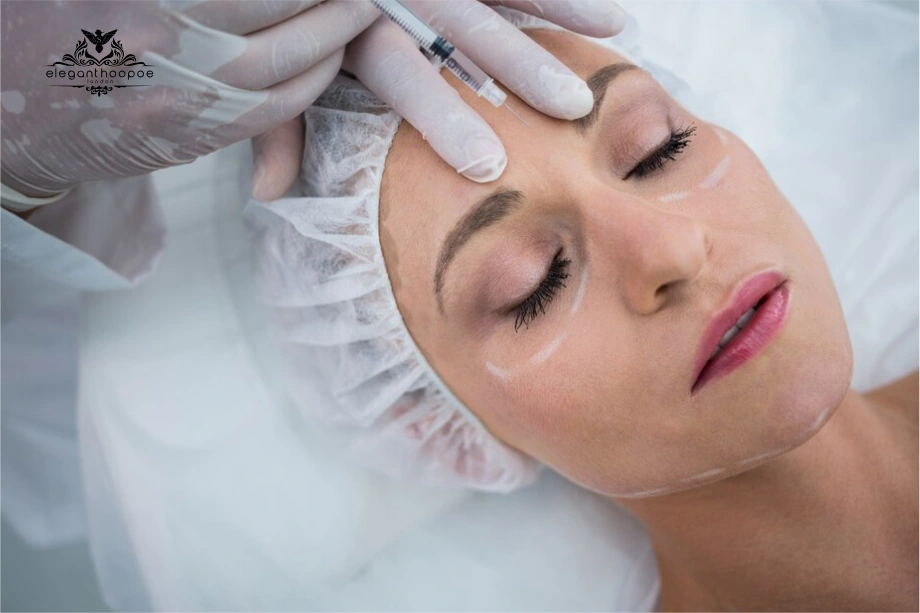 Woman with marker lines on forehead receiving Botox injection