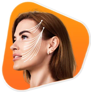Cheek Augmentation