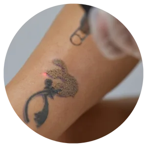 Tattoo Age & Depth