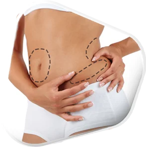 Small Localized Body Areas 