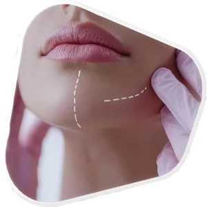 Jawline & Chin Contouring