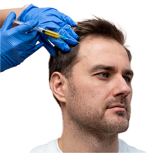 Medical professional administering PRP injections to a patient’s scalp to support hair restoration and address thinning.