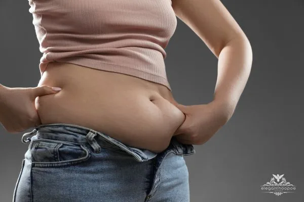 BMI for Women: Understanding Gender Differences in BMI