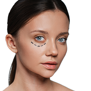 Close-up of under-eye area, illustrating targeted injectable treatment for dark circles and fine line reduction.