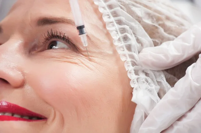 Botox treatment targeting crow’s feet around the eyes.