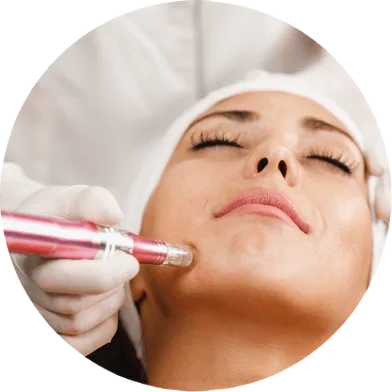 A satisfied patient receives microneedling treatment at Clinic in Dubai